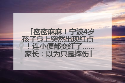 密密麻麻！宁波4岁孩子身上突然出现红点！连小便都变红了……家长：以为只是摔伤
